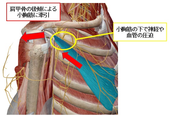 胸郭出口.jpg