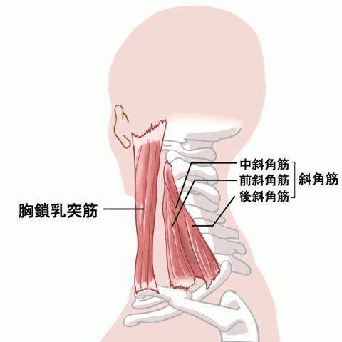 胸郭出口症候群でお悩みの方へ