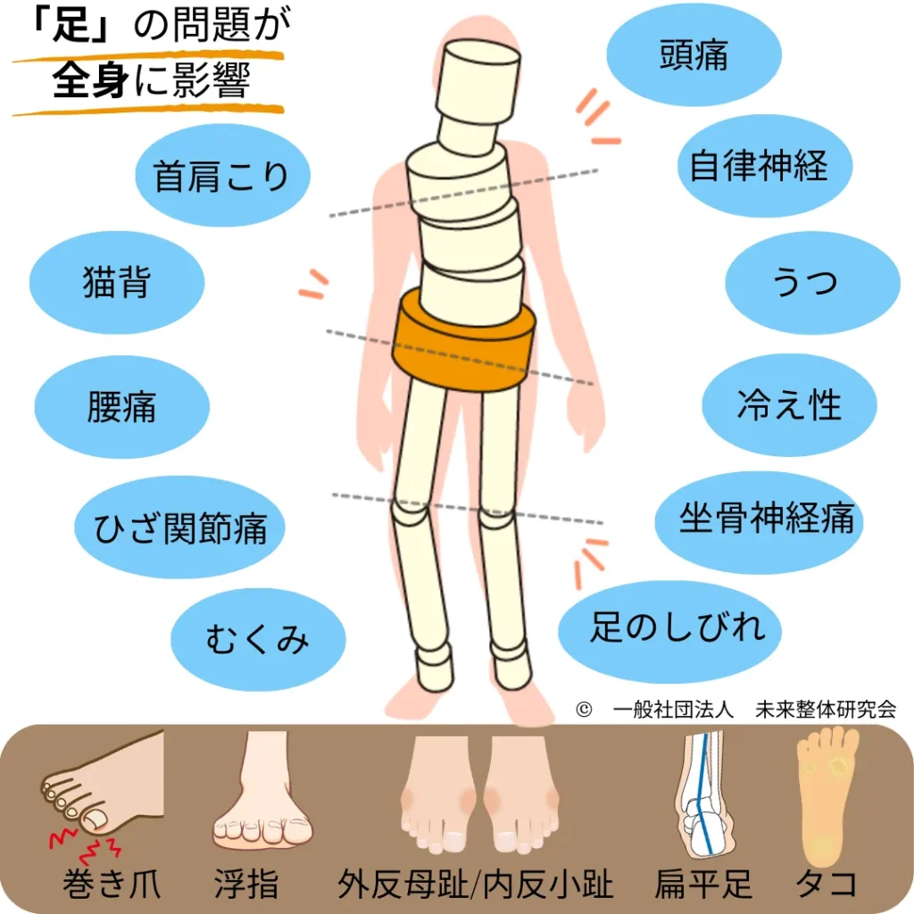 足の問題が全身の歪みに