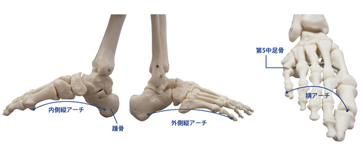 アーチ