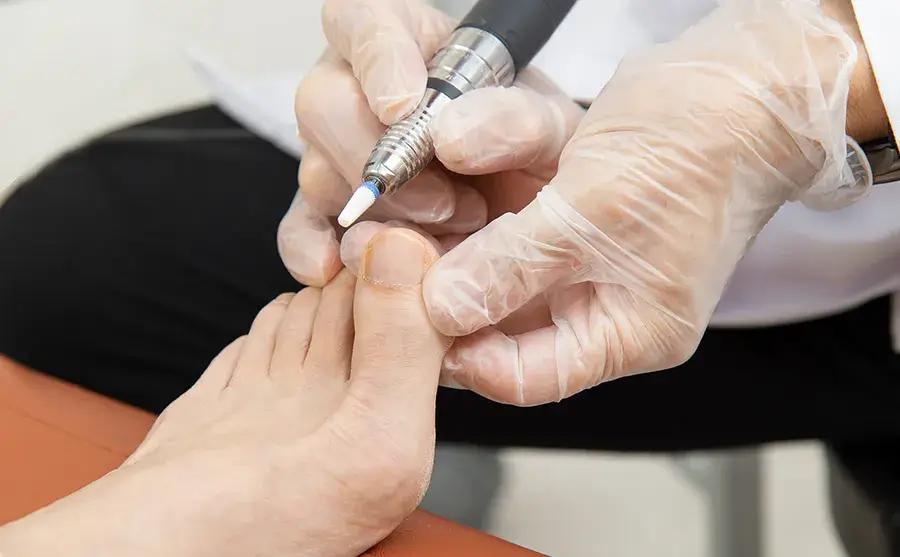 巻き爪施術　幹整体委員