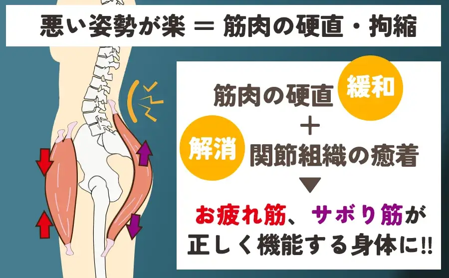 悪い姿勢が楽＝筋肉の硬直と拘縮 筋肉の硬直緩和＋解消関節組織の癒着