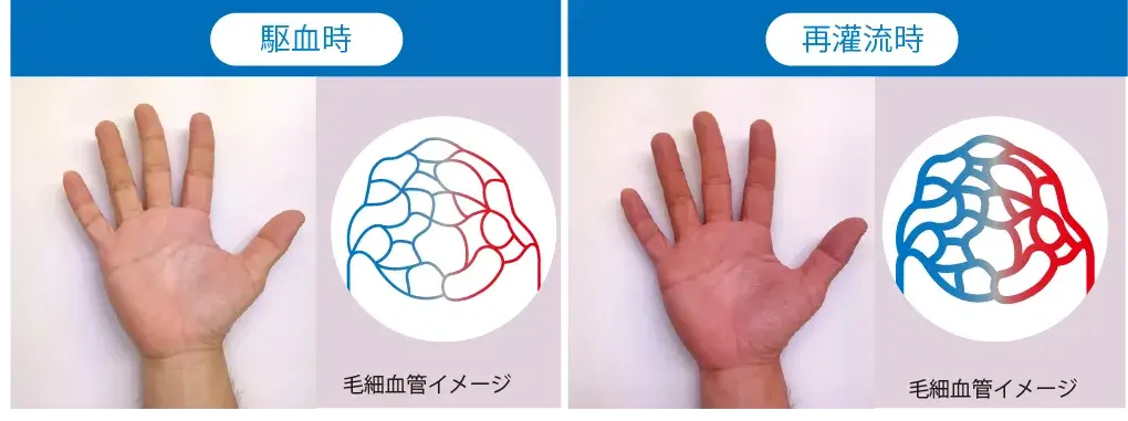 毛細血管