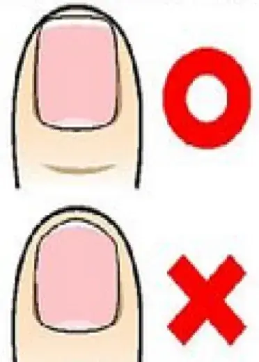 爪の切り方　幹整体院