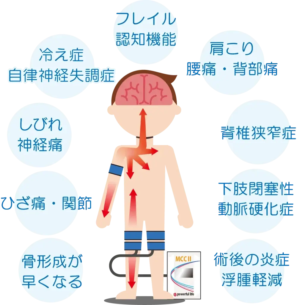 RIC効果