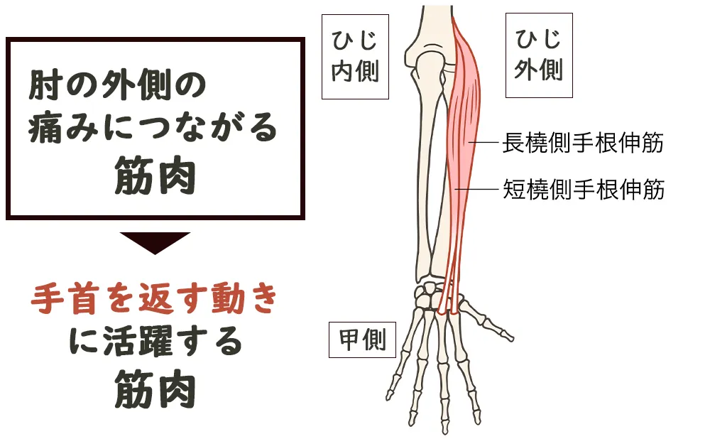 テニス肘肘の外側の痛みにつながる筋肉