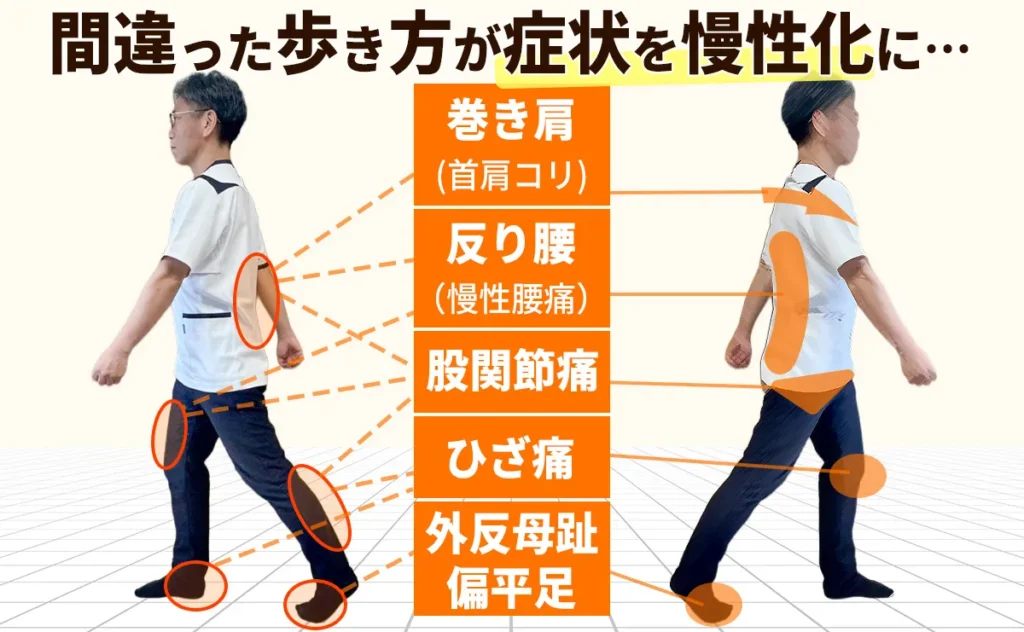間違った歩き方が症状を慢性化させている